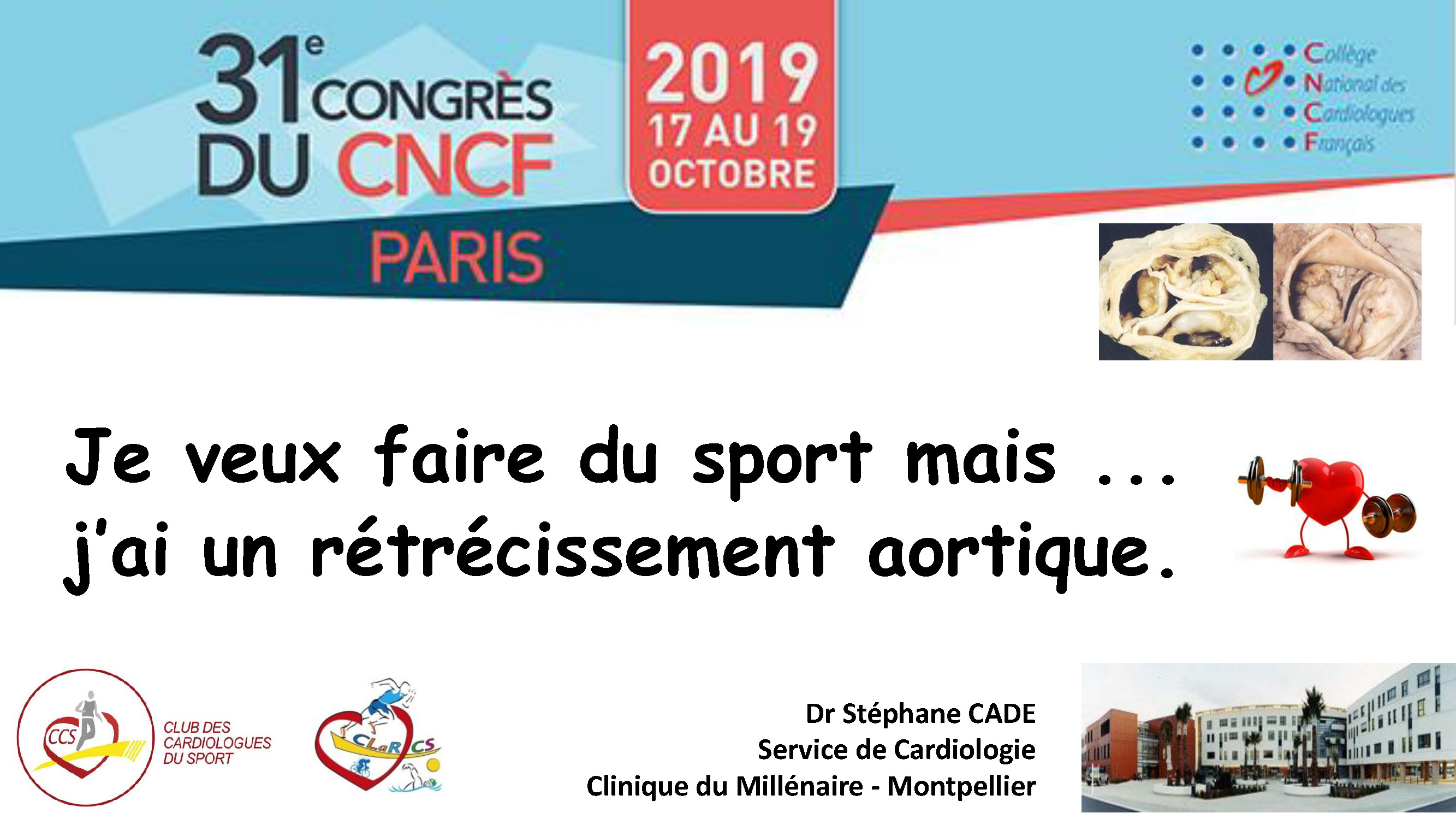 Cœur et sport : cardiologie et santé 
