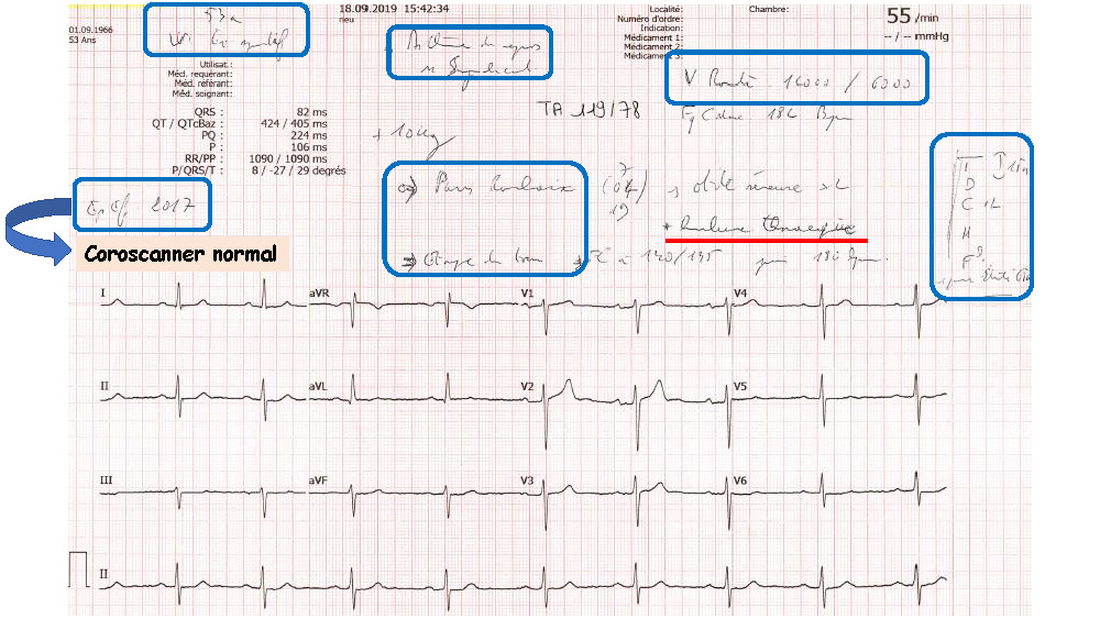 Cœur et sport : cardiologie et santé 