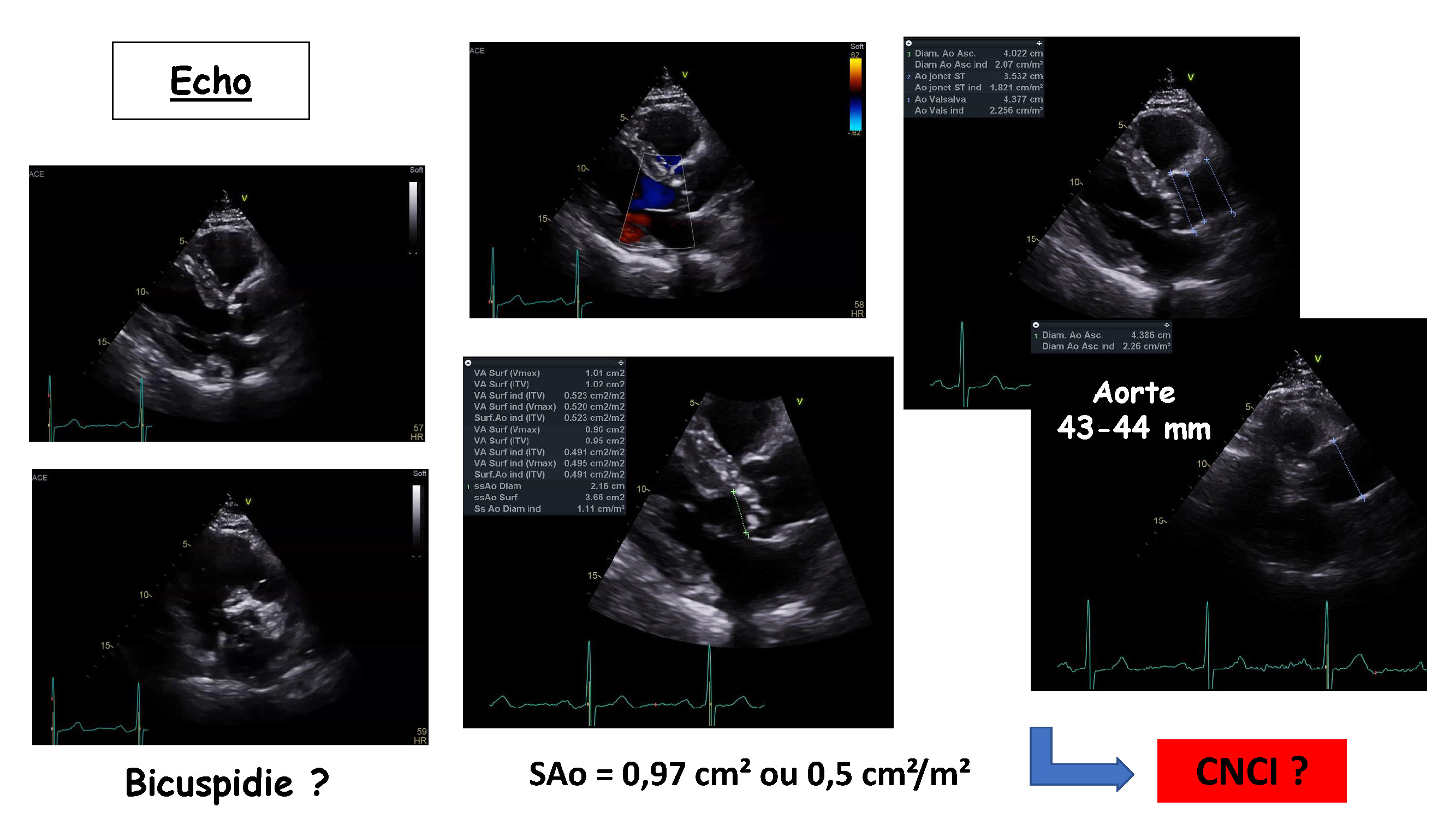Cœur et sport : cardiologie et santé 