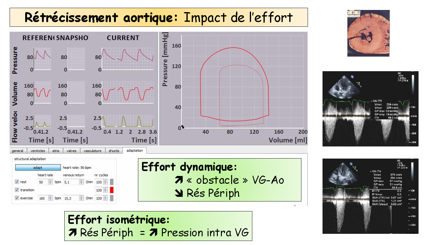 Cœur et sport : cardiologie et santé 