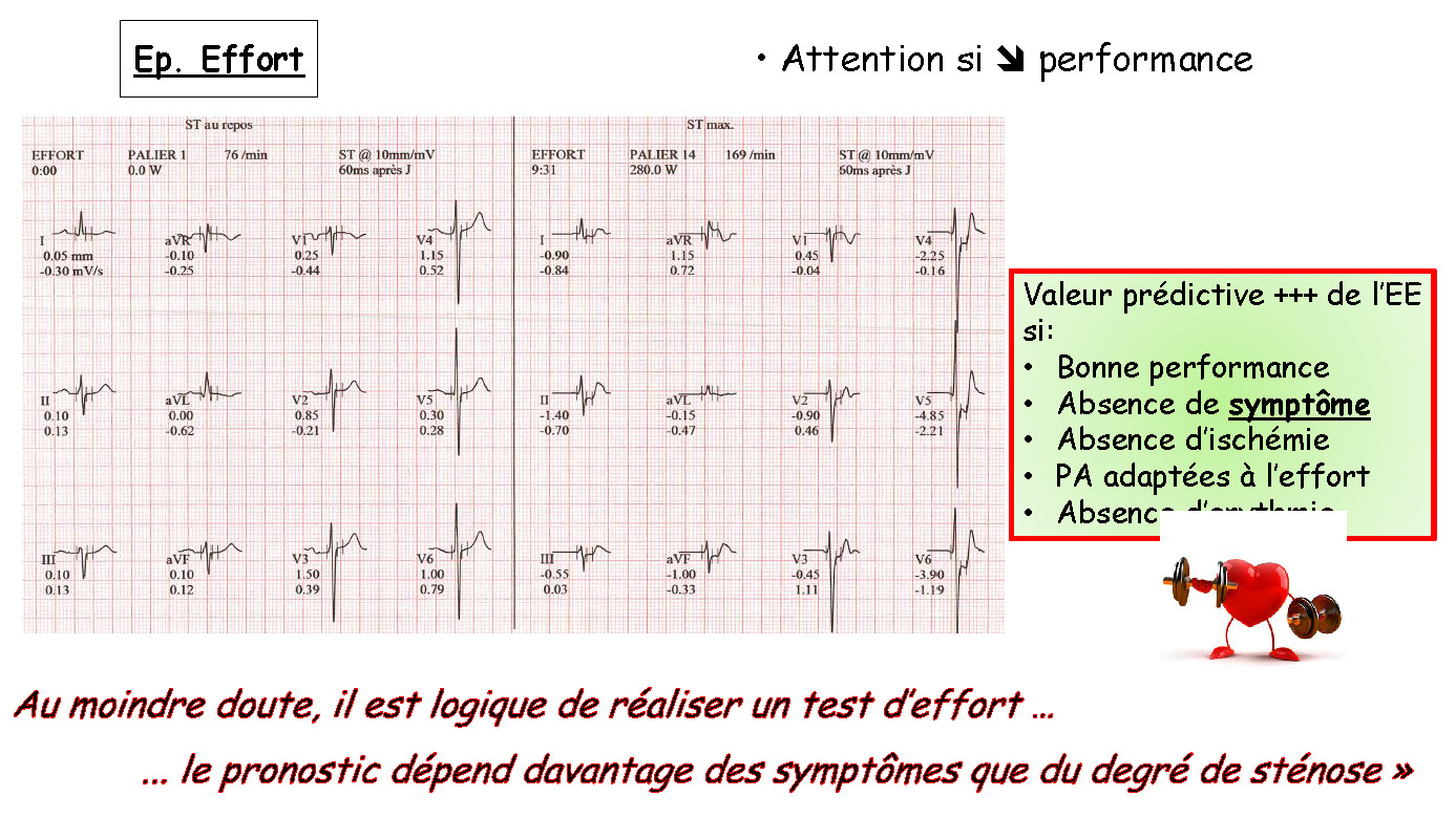 Cœur et sport : cardiologie et santé 