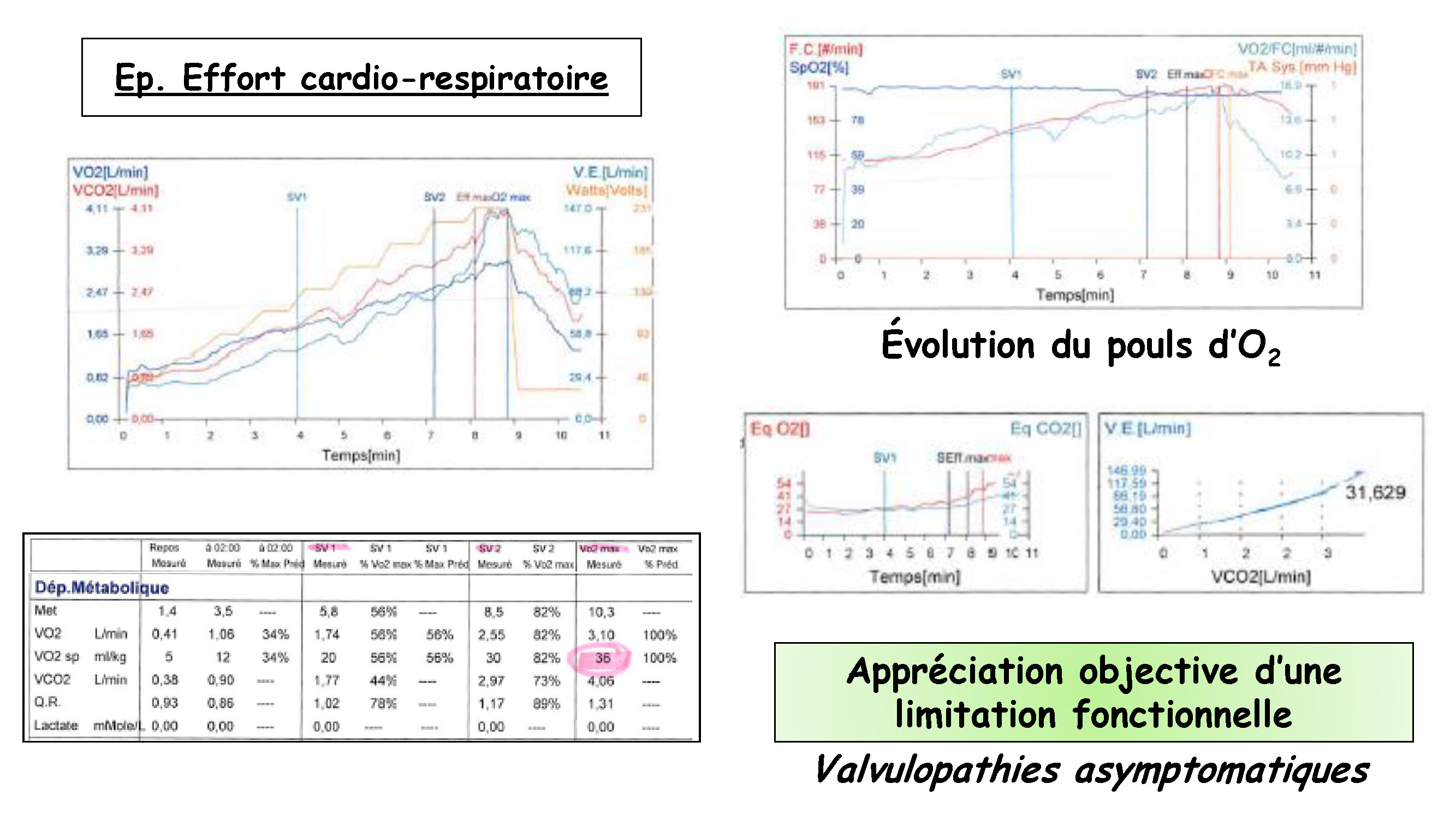 Cœur et sport : cardiologie et santé 