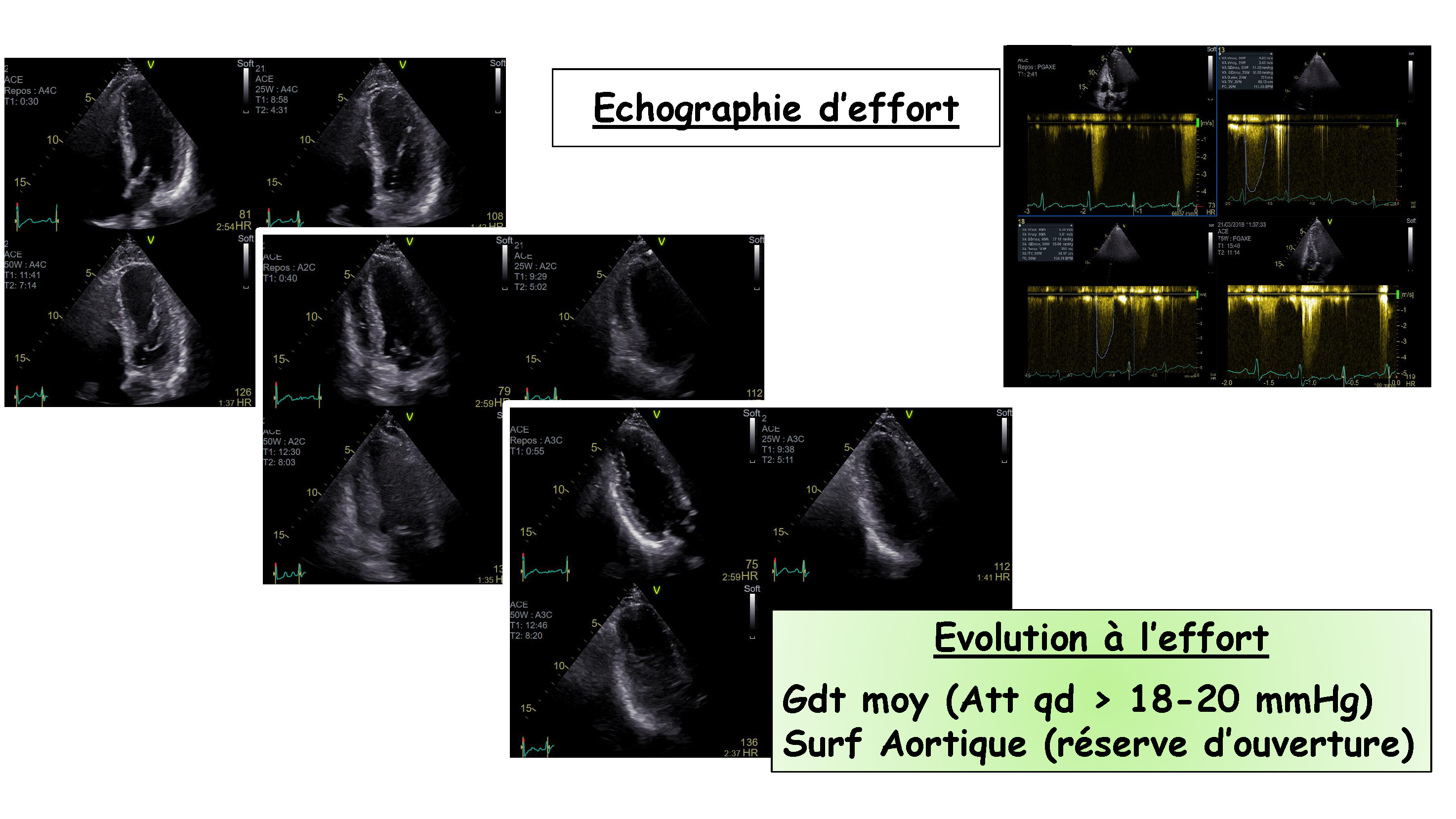 Cœur et sport : cardiologie et santé 