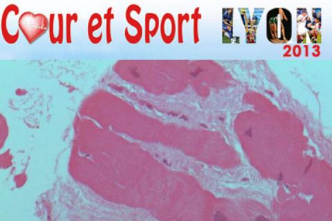 SOUFFRANCE MYOCARDIQUE 