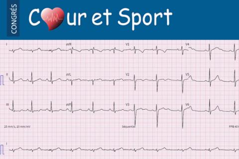 Les situations difficiles en cardiologie du sport