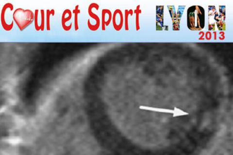 PLACE DE L'IRM CARDIAQUE DANS LE DIAGNOSTIC DU CŒUR D’ATHLÈTE