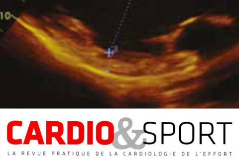 Fibrose et sport