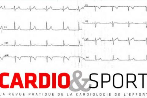 A PROPOS DE L'ANOMALIE D'EBSTEIN