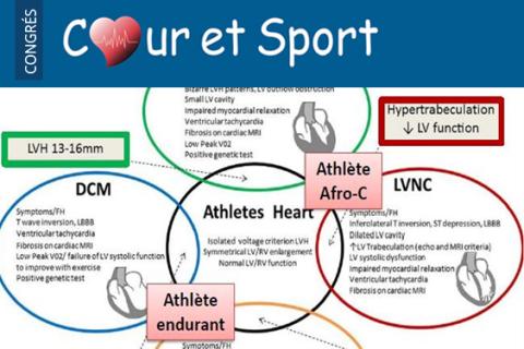 Imagerie du Cœur d’athlète