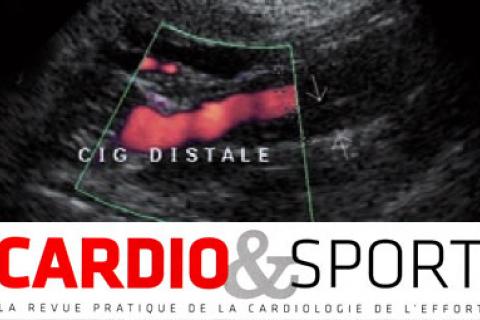 DISSECTION ARTÉRIELLES CERVICO-ENCÉPHALIQUES ET SPORT 