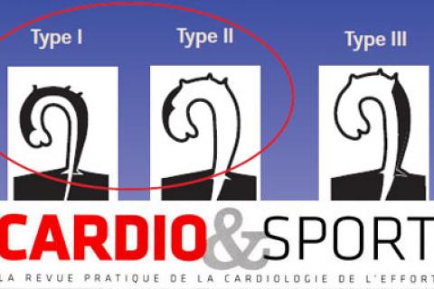 ENTRAINEMENT A L'EFFORT