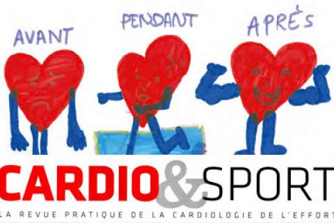 INTENSITE D'ENTRAINEMENT EN READAPTATION CARDIAQUE