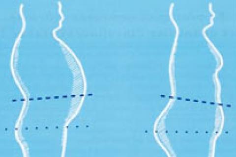 PRÉVENTION CARDIO-VASCULAIRE CHEZ LA FEMME APRÈS 50 ANS