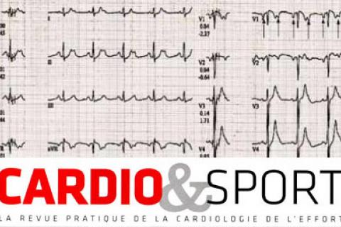 UNE FRÉQUENCE CARDIAQUE QUI BAISSE À L'EFFORT